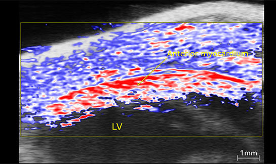 Cardiovascular - Anterior myocardium oxygenation, high O2 stats in red, low in blue.jpeg