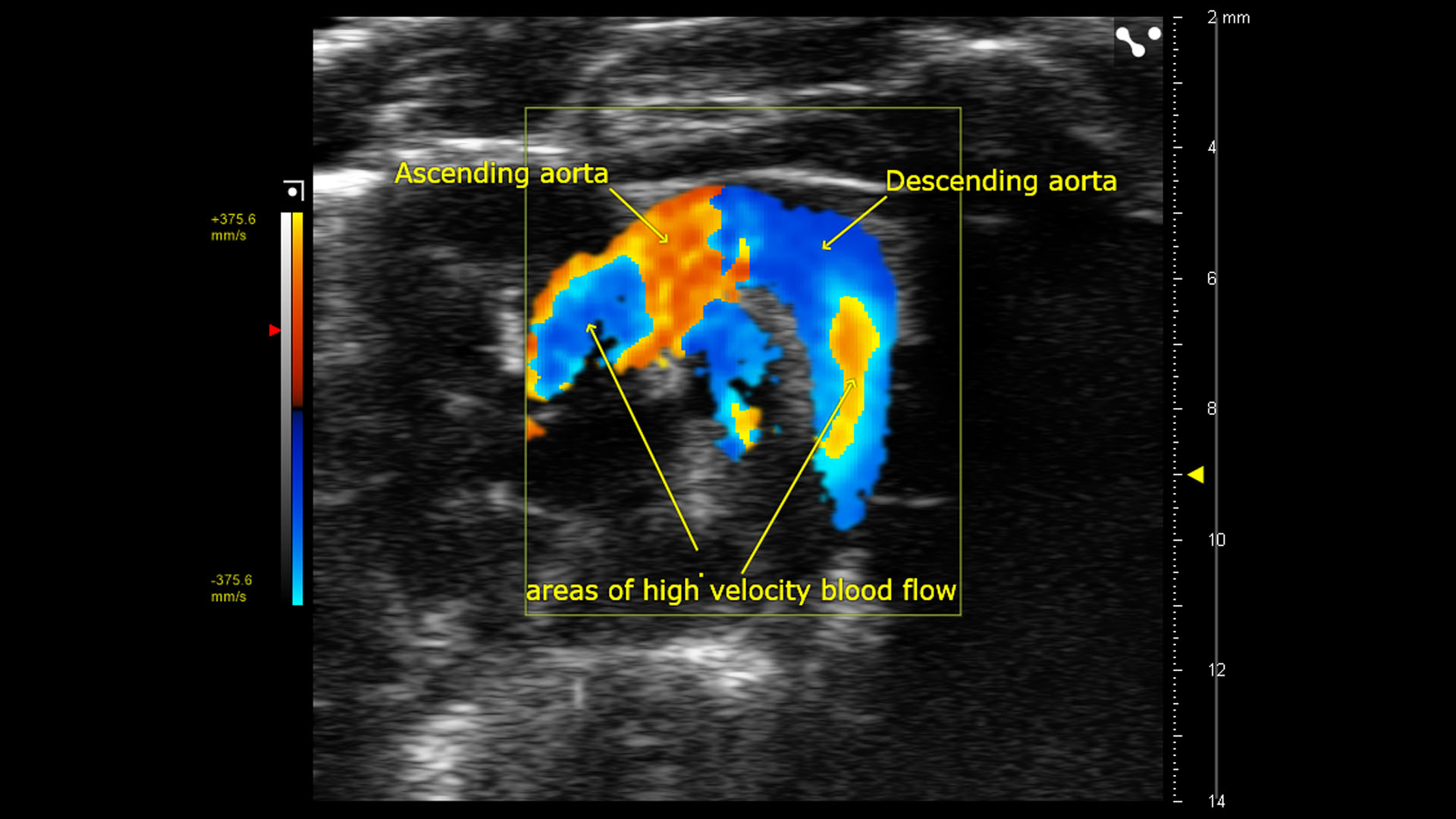 Color Doppler of Mouse Aortic Arch