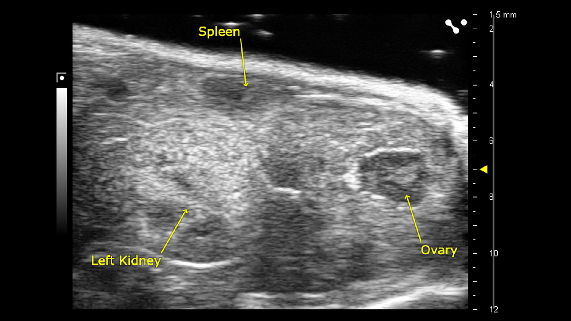 B-mode of the ovary, spleen and kidney