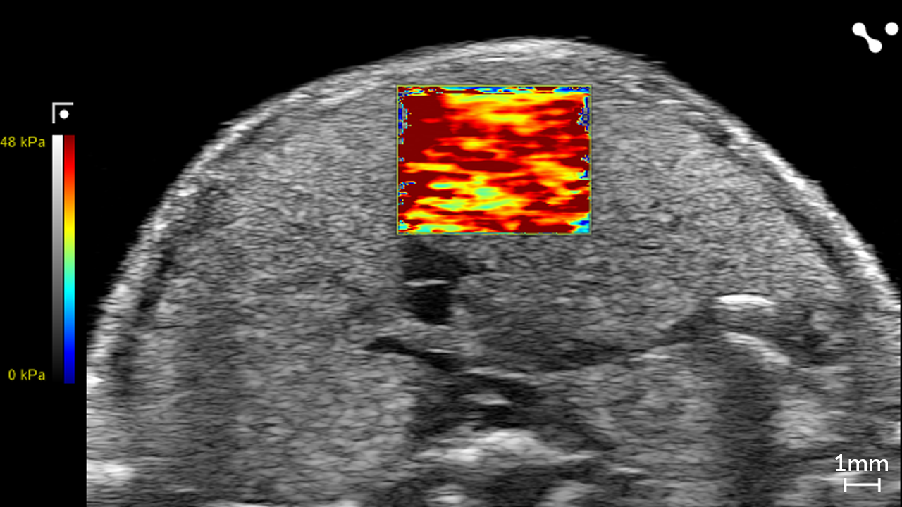 Liver in a NAFLD/MASLD Mouse showing Stiffness through Shear Wave Elastography