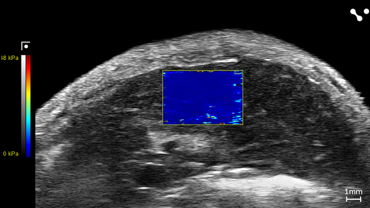 Liver in a Control Mouse showing Stiffness through Shear Wave Elastography