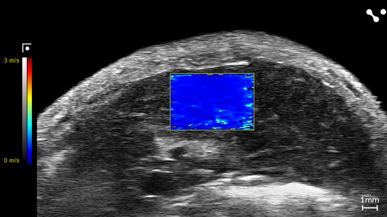 Liver in a Control Mouse showing Velocity through Shear Wave Elastography