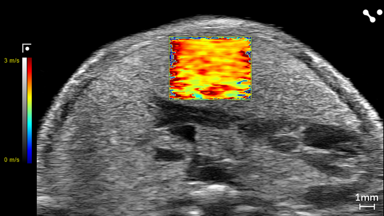 Liver in a NAFLD/MASLD Mouse showing Velocity through Shear Wave Elastography