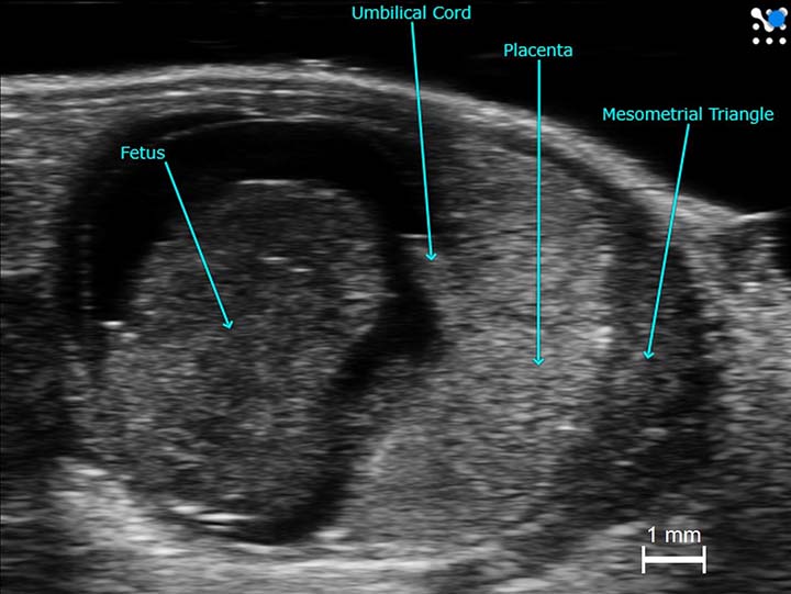 Imaging flow of the standard B-mode ultrasound imaging. PRF