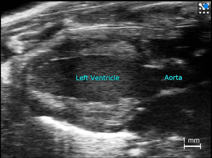 B-mode ultrasound gave us images