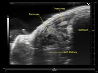 Ultrasound guided free hand injection into the murine pancreas