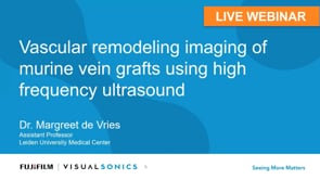 January 2021: Vascular remodeling imaging of murine vein grafts using high frequency ultrasound
