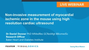 February 2020: Non-invasive measurement of myocardial ischemic zone in the mouse using high resolution cardiac ultrasound