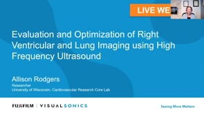 May 2021: Evaluation and Optimization of Right Ventricular and Lung Imaging using High Frequency Ultrasound
