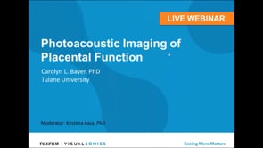 January 2017: Photoacoustic Imaging of Placental Function