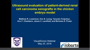 May 2016: Ultrasound evaluation of PDX renal cell carcinoma in the chicken embryo model