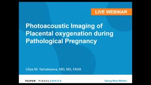 February 2018 Photoacoustic Imaging of Placental oxygenation during Pathological Pregnancy