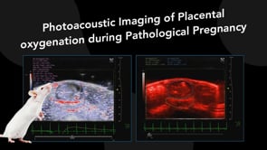 February 2018: Contrast-Enhanced Ultrasound Imaging Advanced Data Analysis with Vevo CQ