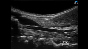 Vascular Strain Analysis on Left Common Carotid Artery of a Mouse - B Mode