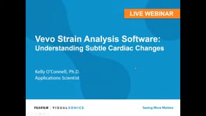 October 2017: Vevo Strain - Understanding Subtle Cardiac Changes