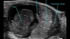 Murine Mid-Gestational Fetus and Placenta