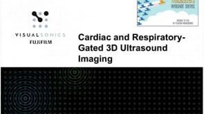 November 2015: Cardiac and Respiratory-Gated Volumetric Murine Ultrasound