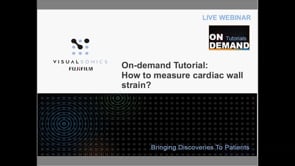 April 2015: How to Measure Cardiac Wall Strain?