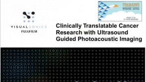 October 2015: Clinically Translatable Cancer Research with Photoacoustic Imaging