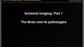 September 2014: Ischemia Imaging - The Brain and Its Pathologies