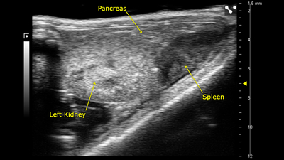 B-mode of the left kidney, spleen and pancreas