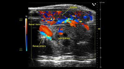 Color Doppler of renal vein, artery, left kidney and spleen