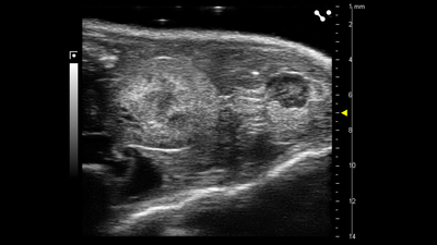 B-mode of a mouse ovary and kidney