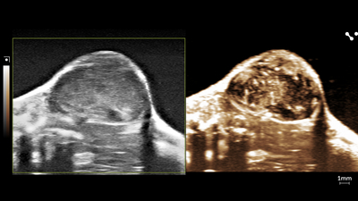 Contrast image of a mouse tumor showing shear wave elastography, scanned using a UHF29x transducer.