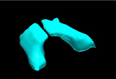 3D Reconstruction of a Murine Thryroid Gland