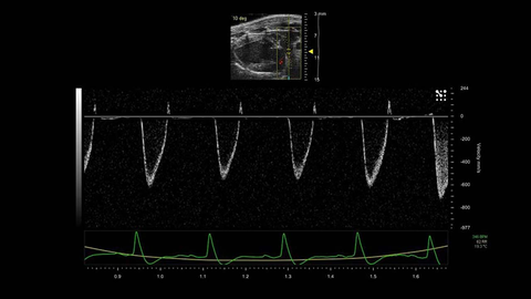 PW Doppler of the Ascending Aorta in a Mouse