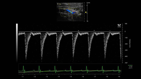 PW Doppler of the Carotid Artery in a Mouse