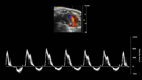 PW Doppler of the Mitral Valve in a Mouse