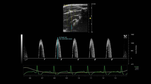 PW Doppler of the Pulmonary Artery in a Mouse