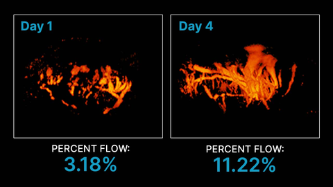 Day 1 Percent Flow of 3.18% vs Day 4 Percent Flow of 11.22% viewed in 3D Power Doppler mode