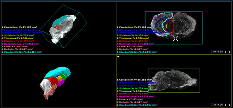 Mouse brain atlas using Vevo LAB