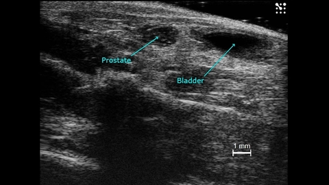 Mouse Prostate