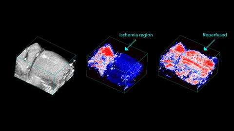 B-Mode of mouse hindlimb and Photoacoustic imaging of oxygen saturation during ischemia and after perfusion