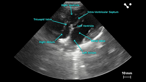 Apical 4-Chamber of Beagle. arrows pointing to the right and left ventricles. tricuspid valve, right and left atriums, mitral valve, and intra-ventricular septum.