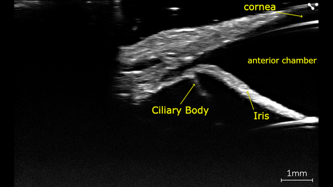 In vivo canine eye with ciliary processes, imaged with high-frequency on the Vevo F2 scanned using the UHF71x.