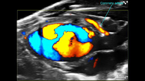 Ultrasound image of mouse heart, calling out the coronary artery