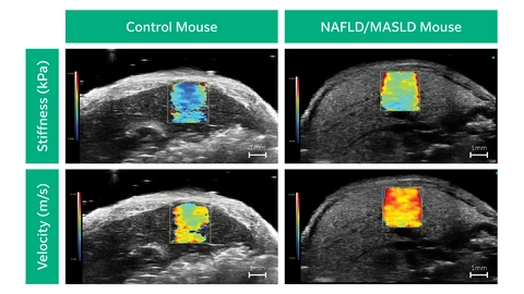 Four ultrasound images showcasing the difference between the control mouse and the NAFLD/MASLD mouse.