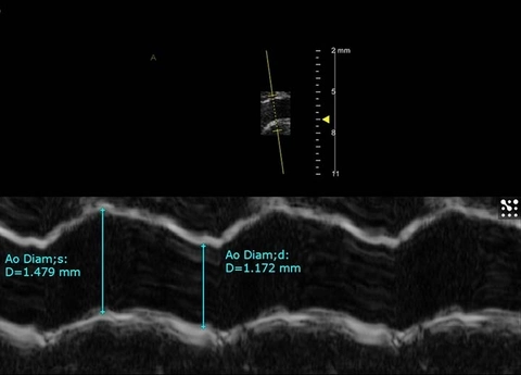 AM Mode of Aorta.jpg