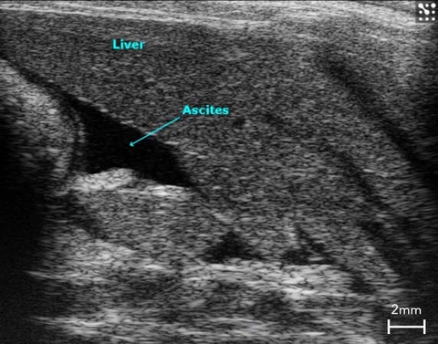 Ascite-in-Rat-Liver.jpg