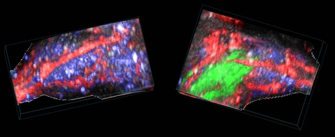 Cell-injected-vs-control-unmixed.jpg