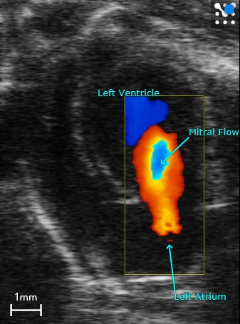 Diastolic Function in a Mouse