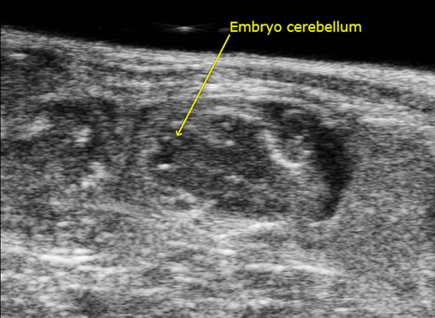 Embryo Cerebellum.jpg