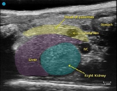 Healthy pancreas head.jpg