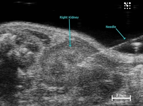 Image Guided Injection into the Mouse Kidney