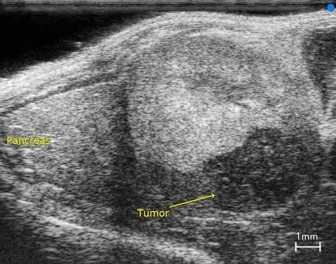 Left-Kidney-in-Mouse-with-Subcapsular-Tumor.jpg