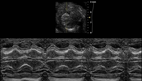 M-Mode of Late Gestational Mouse Fetal Heart